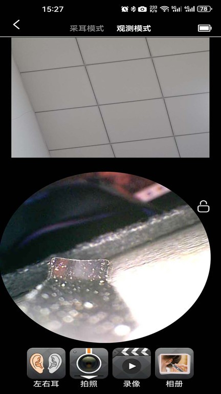 cuckooyun可视采耳app